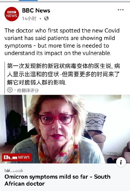 大家说说看感染奥密克戎会更严重吗?米国在这样下去全完了