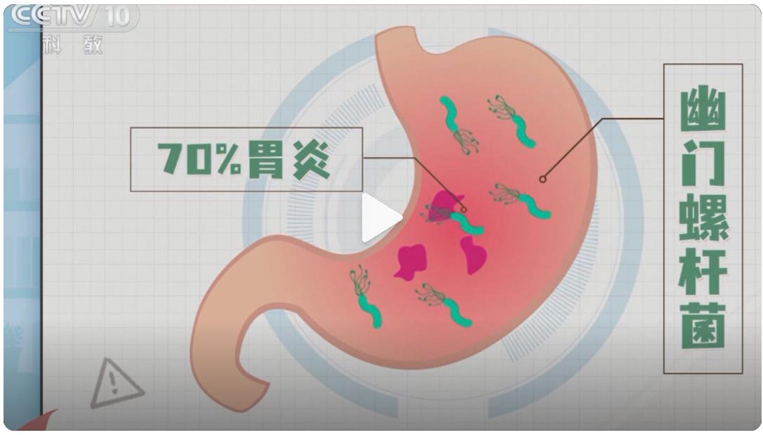 感染幽门螺杆菌后有什么症状?易患哪些疾病给患者带来痛苦?