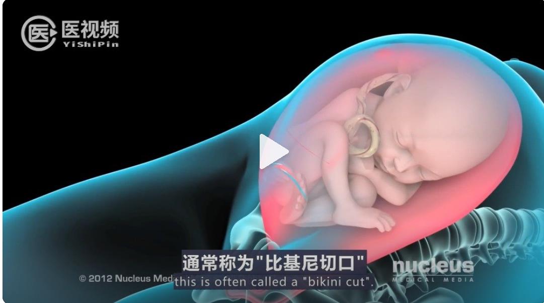 宝妈们的剖腹产到底有多疼男人这辈子都是无法体会到了