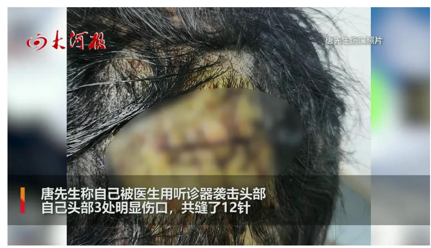 深圳坂田医院发烧病人排队2小时过号被拒诊起冲突.头被打破