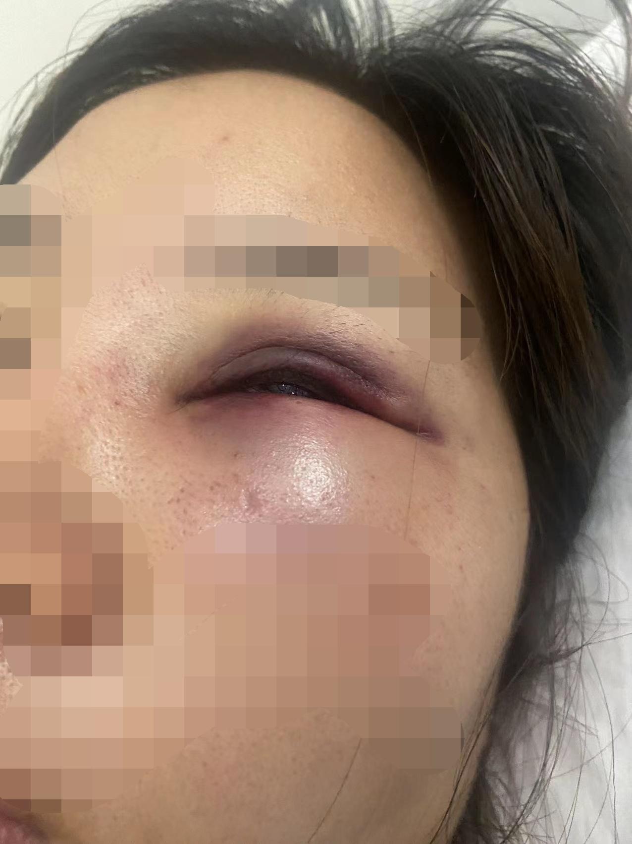 女子柬埔寨遭性侵后还要付小费.被威胁不翻供就报复