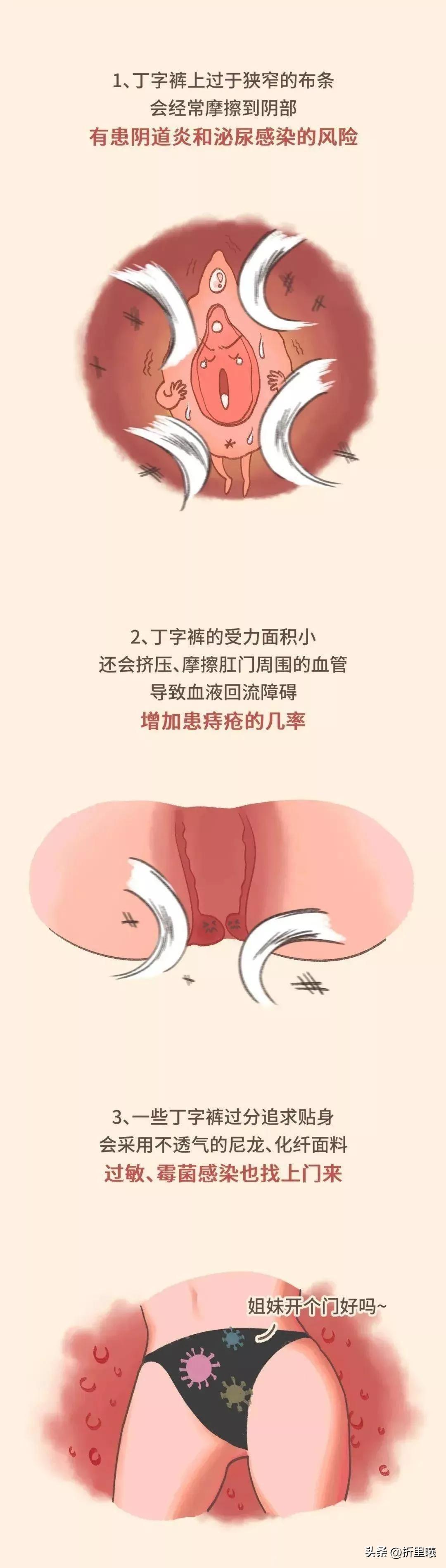 为什么有好多女生都喜欢穿丁字裤呢?这跟健康有关哦.