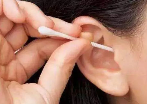 人的耳屎是从哪里来的？耳朵探秘：神奇的黄金守护者