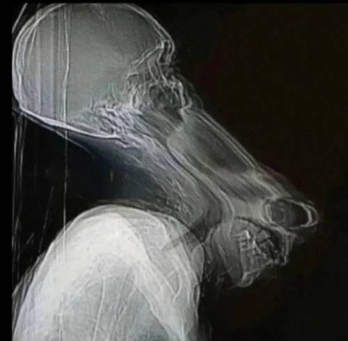 打喷嚏拍片，头骨分离！电影拍摄的灾难时刻！