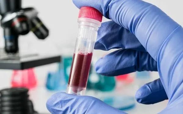 仅通过血液检查就可以确诊癌症？