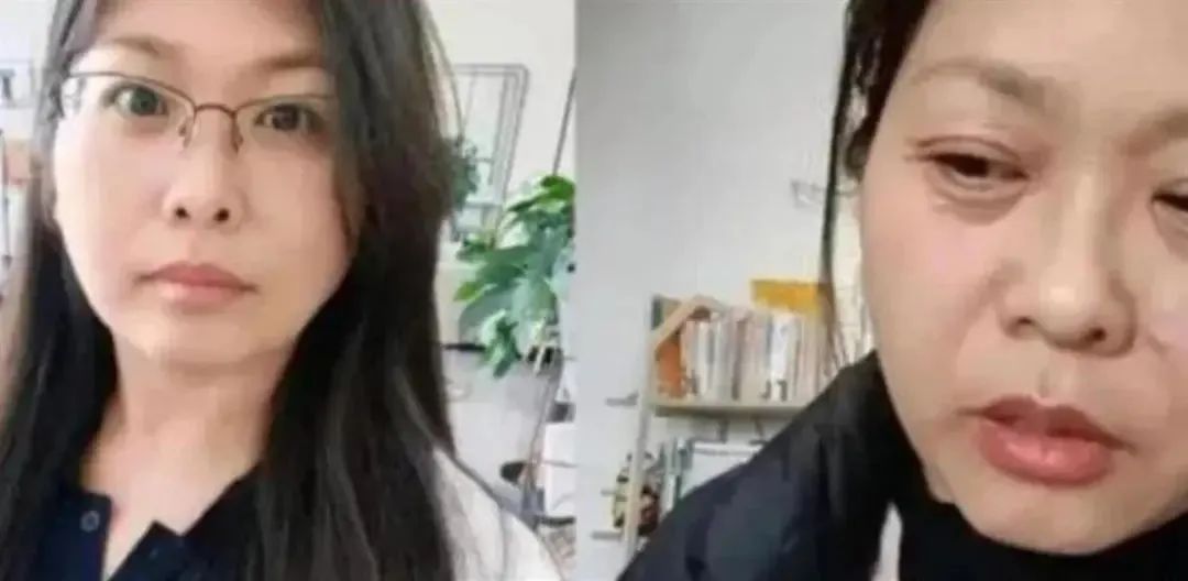 女性绝经不一定意味着快速衰老,科学护理让你健康度过晚年