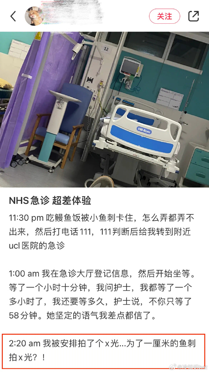 镊子一夹，荡产倾家，为什么只有中国医生擅长取鱼刺呢？