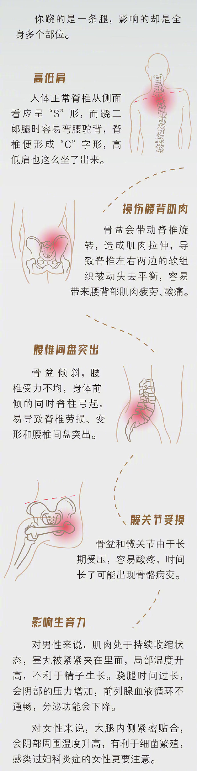 比跷二郎腿伤害更大的坐姿有哪些？警惕腰酸背疼颈肩麻木