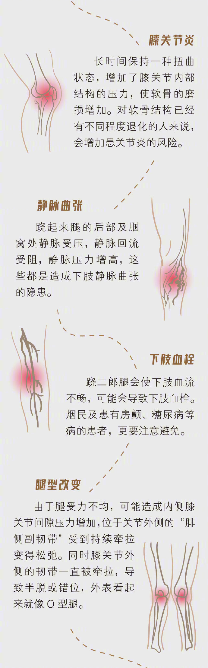 比跷二郎腿伤害更大的坐姿有哪些？警惕腰酸背疼颈肩麻木