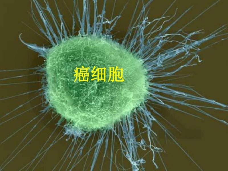 癌症患者想通过节食“饿死”癌细胞，通过减少营养真不可行！