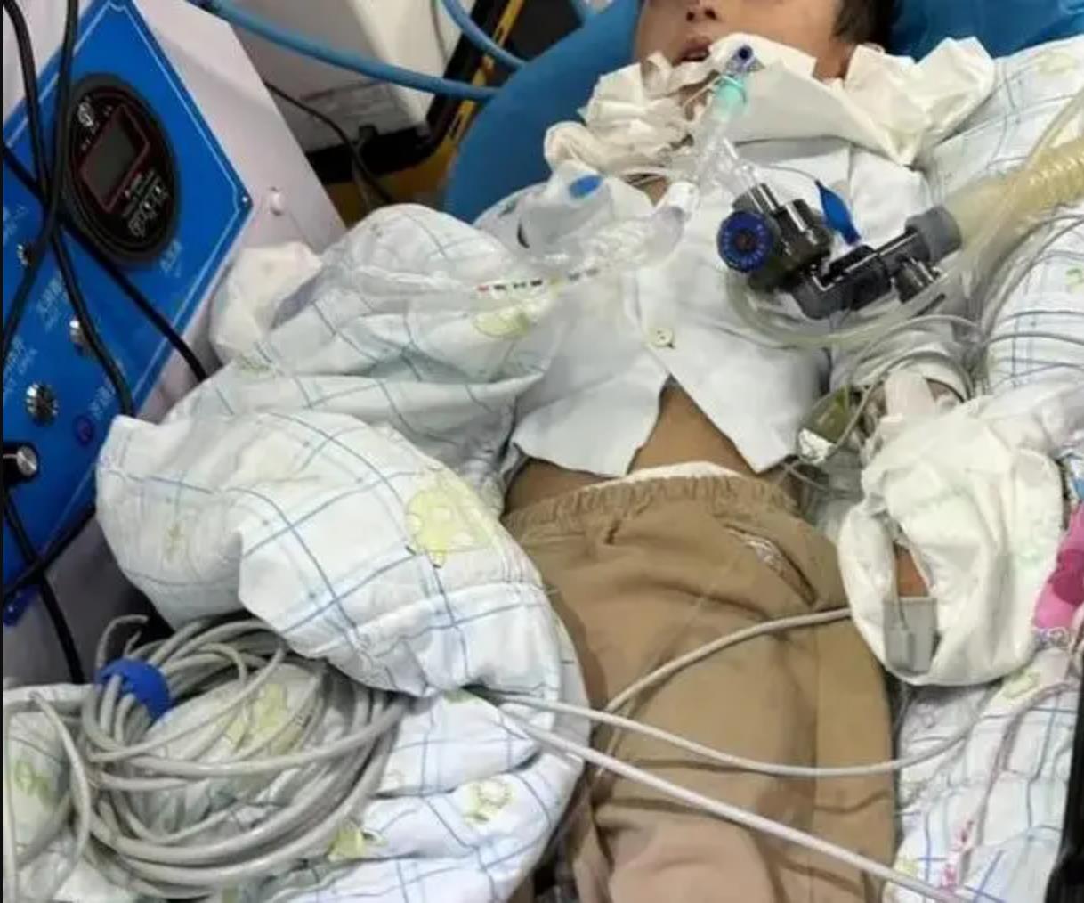 河南3岁男童狂犬病病毒免疫失败问题，一串问号需要解答