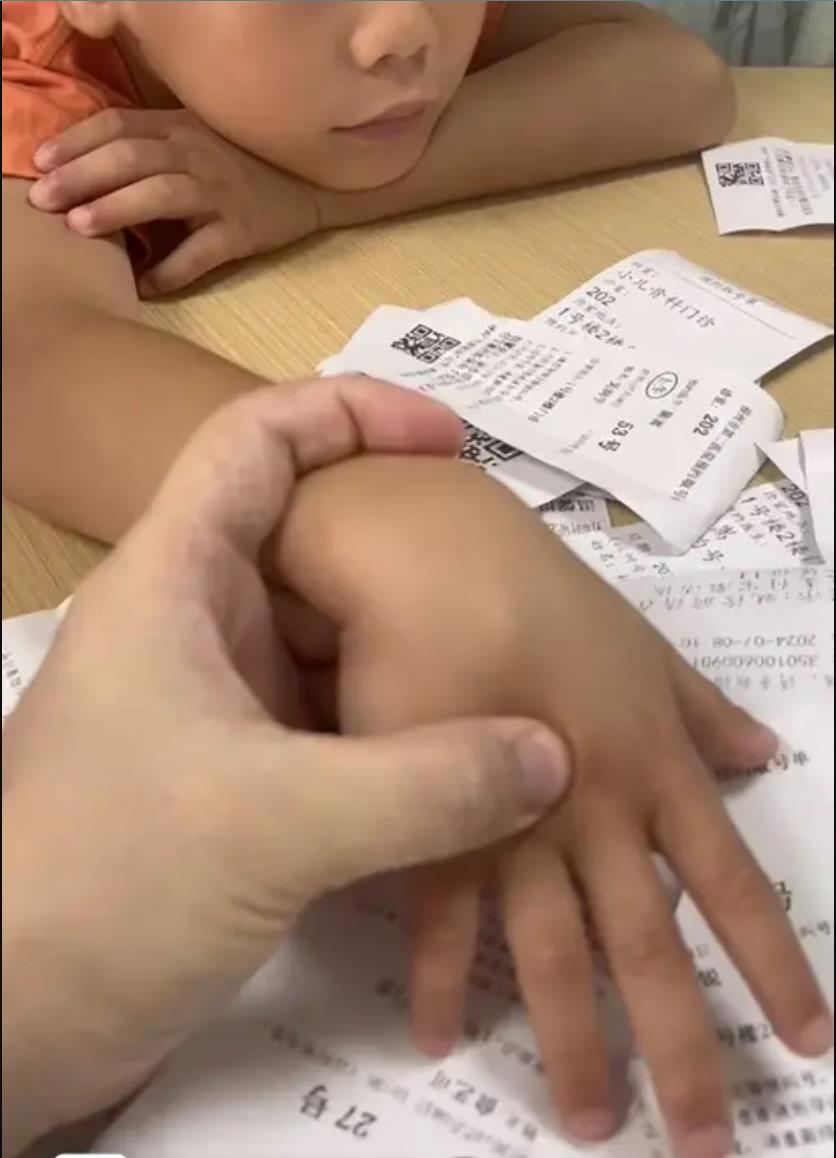 福州9岁男孩打烟卡游戏致腱鞘囊肿，医生提醒暑期加强监护