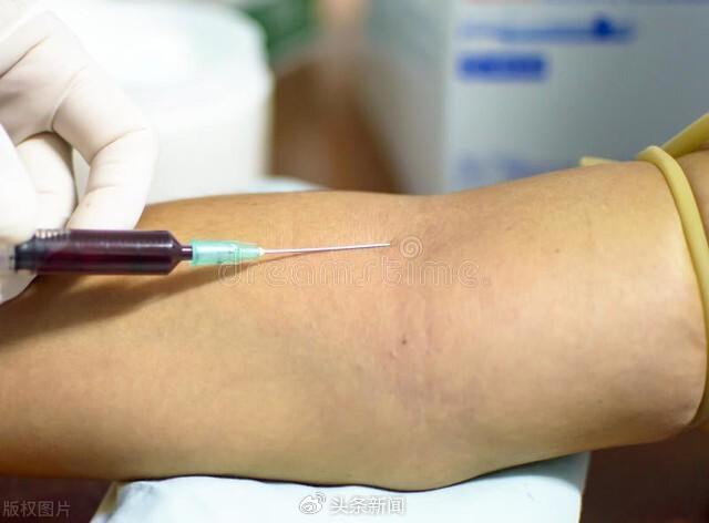 这3个体检项目真的必要去做，其实就是浪费钱