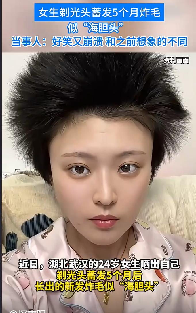 美女剃光头后蓄发炸毛似海胆，尴尬又有趣的摆烂过程