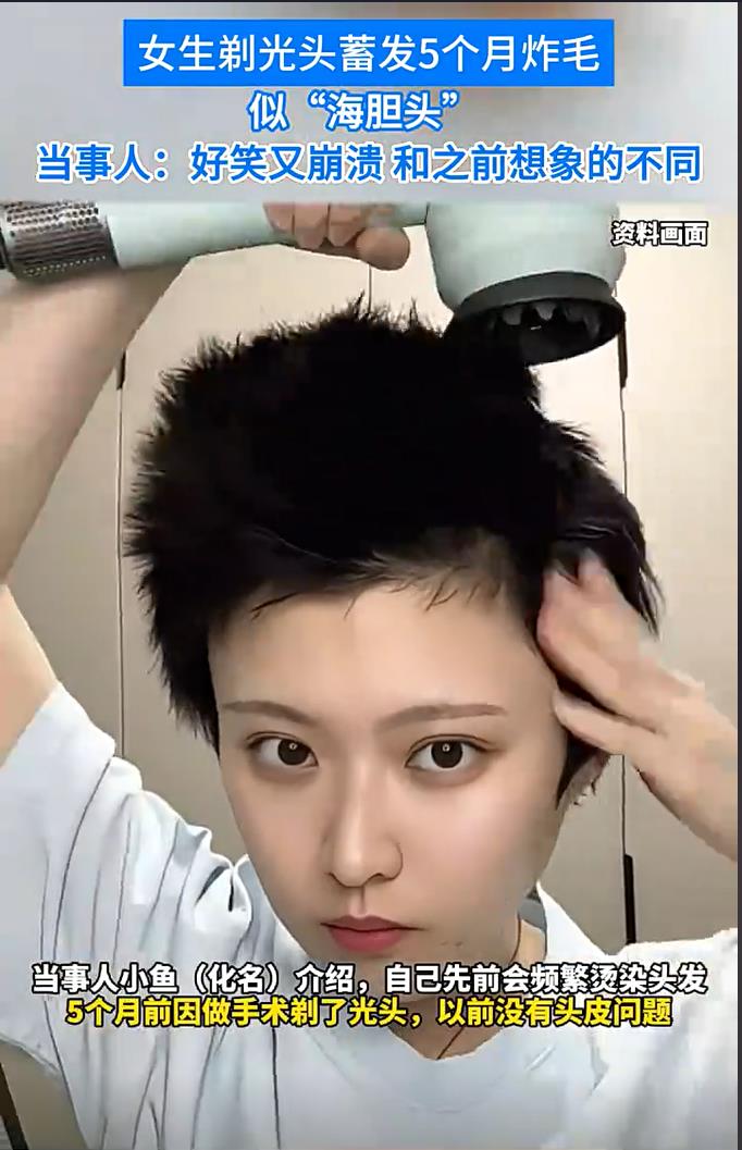 美女剃光头后蓄发炸毛似海胆，尴尬又有趣的摆烂过程