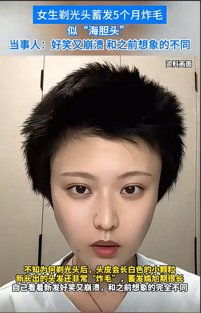 美女剃光头后蓄发炸毛似海胆，尴尬又有趣的摆烂过程
