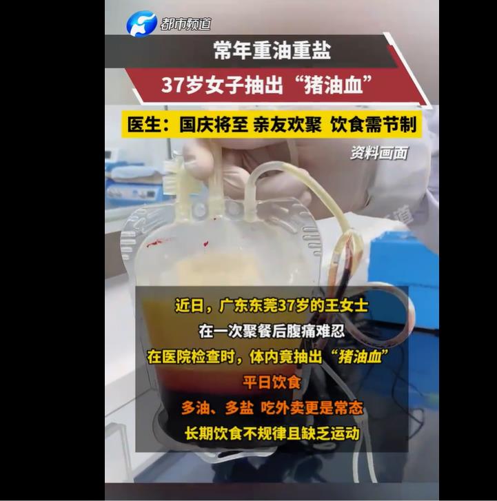 惊！37岁女子体内抽出猪油血，重油重盐饮食敲响健康警钟