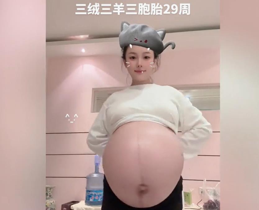 90后宝妈生完双胞胎再怀三胞胎：期待“拆盲盒”