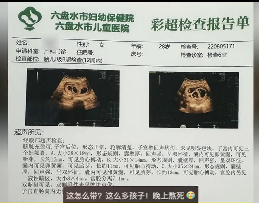 90后宝妈生完双胞胎再怀三胞胎：期待“拆盲盒”