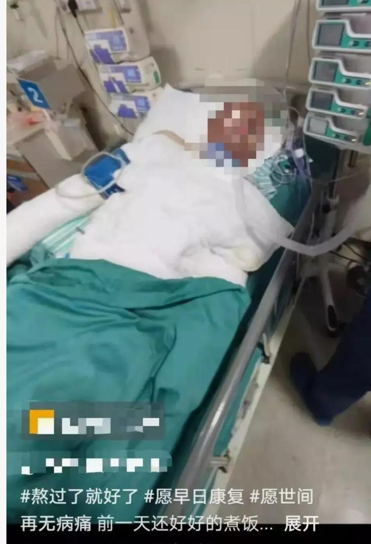 “烧伤妈妈”钢丝球清创收到超百万捐款