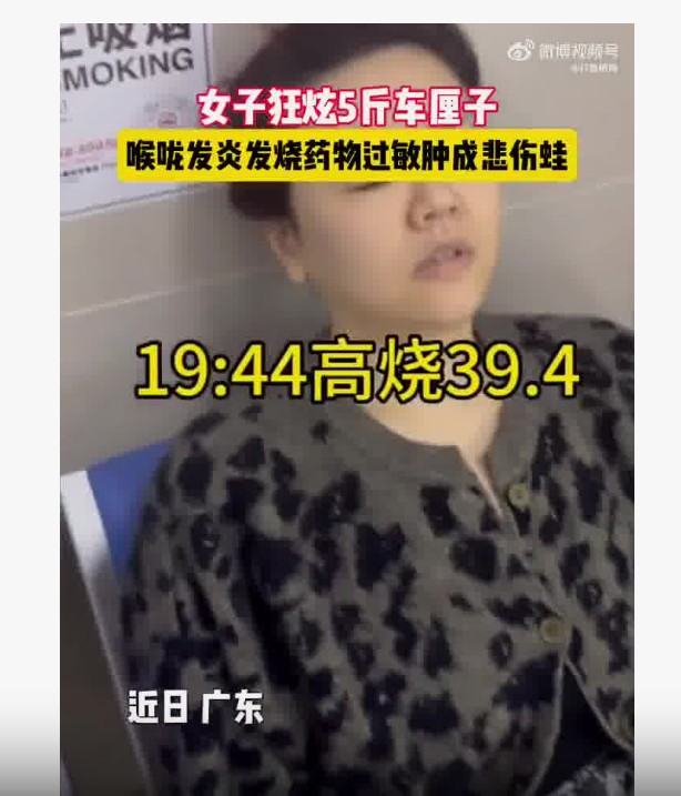 吃车厘子竟吃成“悲伤蛙”？女子狂吃5斤后脸部大变样