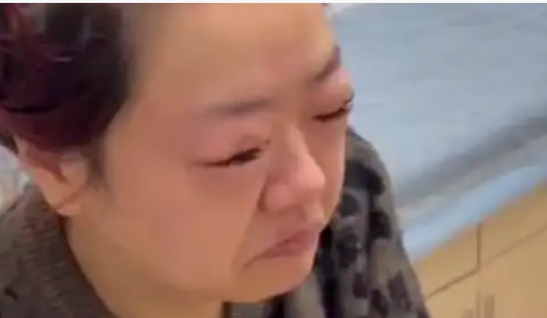 吃车厘子竟吃成“悲伤蛙”？女子狂吃5斤后脸部大变样