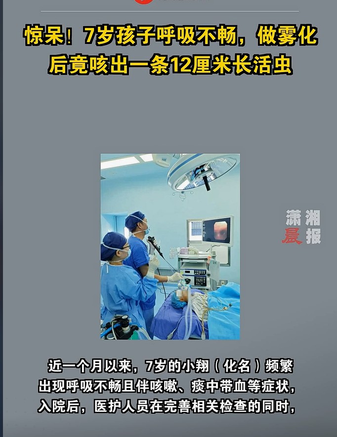 惊！幼童做雾化竟咳出一条活体蚂蟥，肺部严重感染